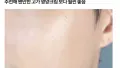 피부과 가면 꼭 있는 웃픈 경험