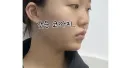 성형 전과 후, 진짜 달라진 건 뭐지?